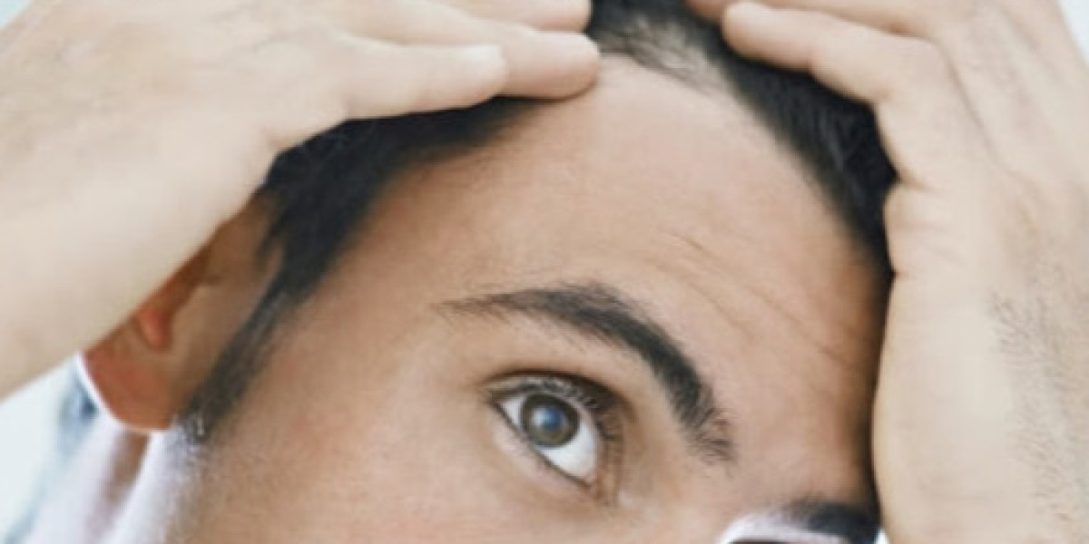 Female Hair Loss and Menopause: Causes, Treatments & Confidence Renewal