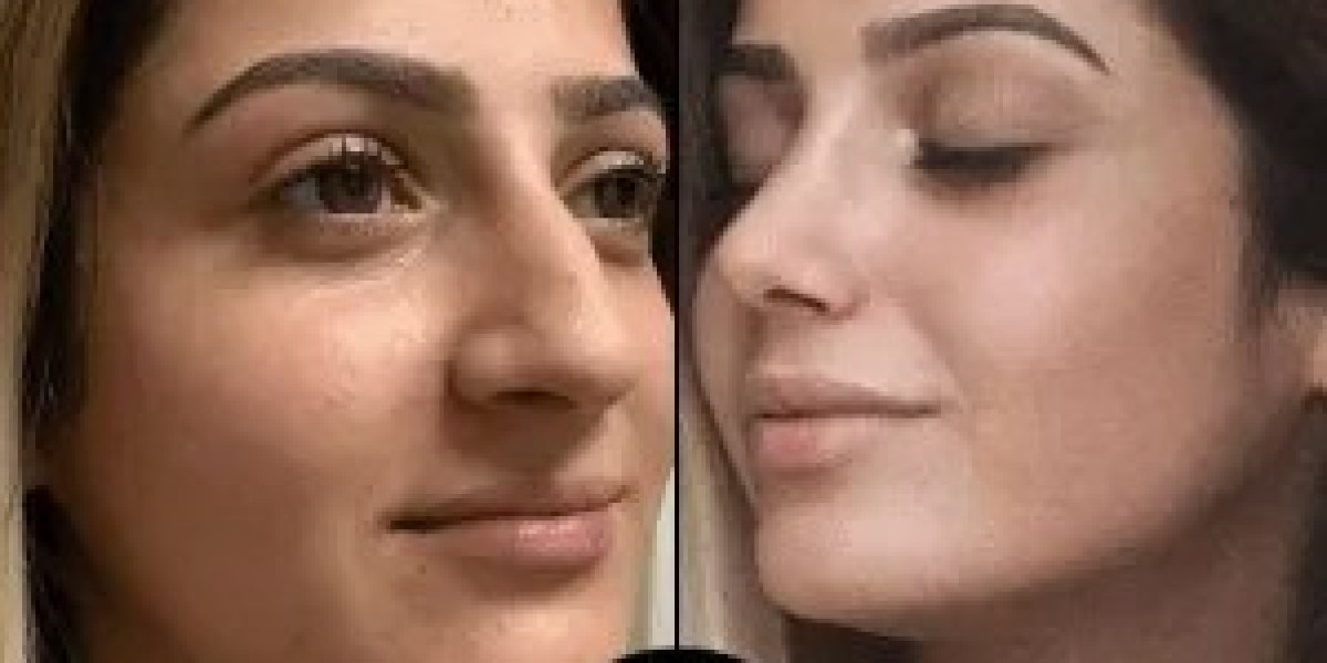 Best Plastic Surgeons in Dubai Offering PRP and Skin Treatments