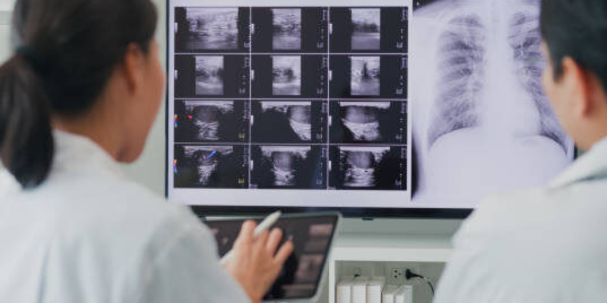 Enhance Diagnostic Accuracy with a Brand new X-ray machine