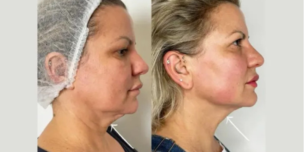Best Plastic Surgeons in Dubai – Creating Timeless Beauty