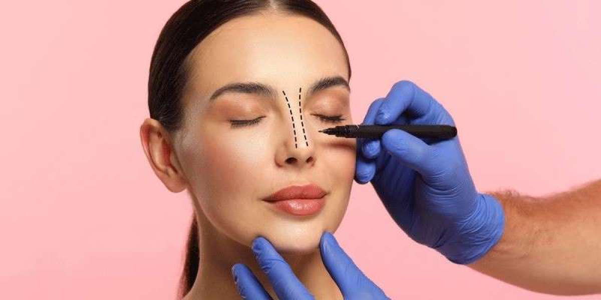 The Art and Science of Rhinoplasty