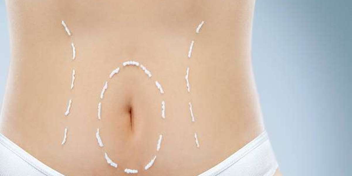 How Much Swelling Is Normal After Liposuction?
