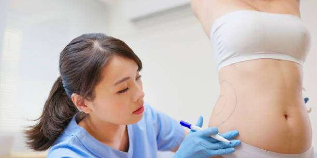 Does Liposuction Procedure Require Drains?