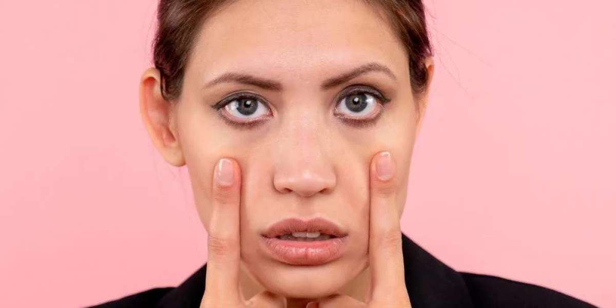 Fresh-Faced Magic: Instant Dark Circles Treatment Boost