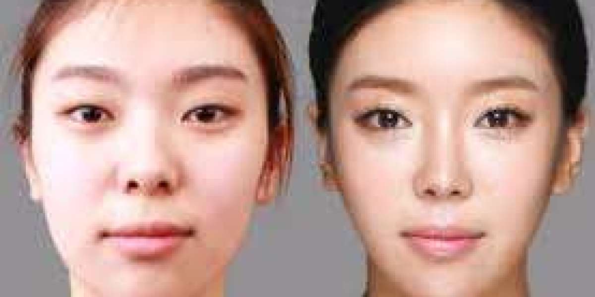Article Picture