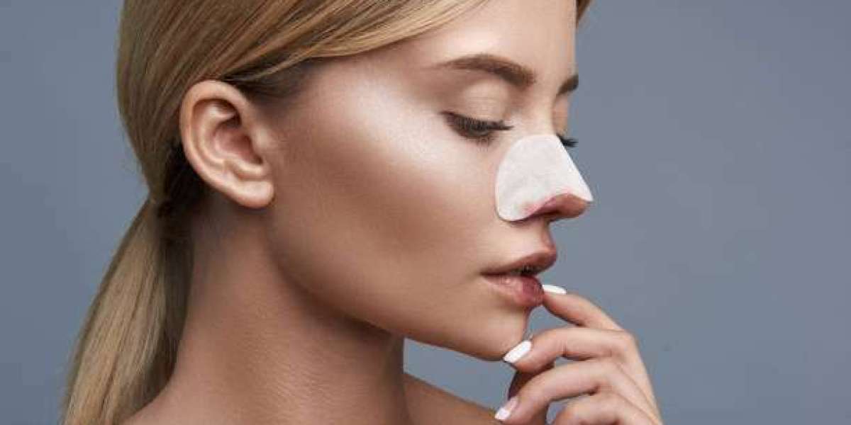 Does Rhinoplasty Work for Wide Noses?