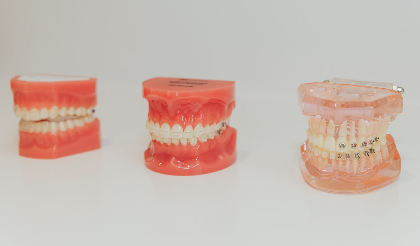 Fixed Braces in Guiseley | Orthodontics | One Two Three Dental
