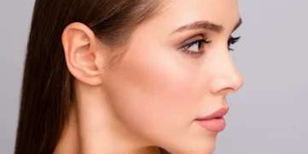 Article Picture