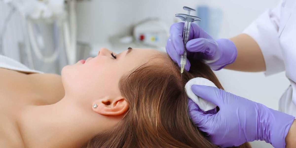 How Exosome Hair in Dubai Supports a Healthier Scalp