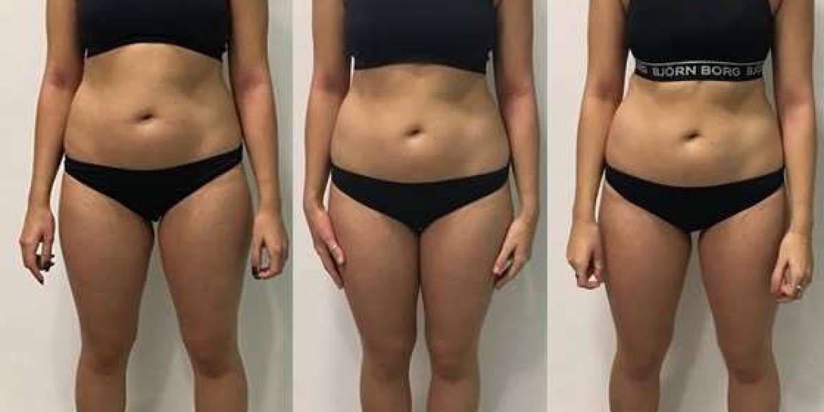 Retafit France