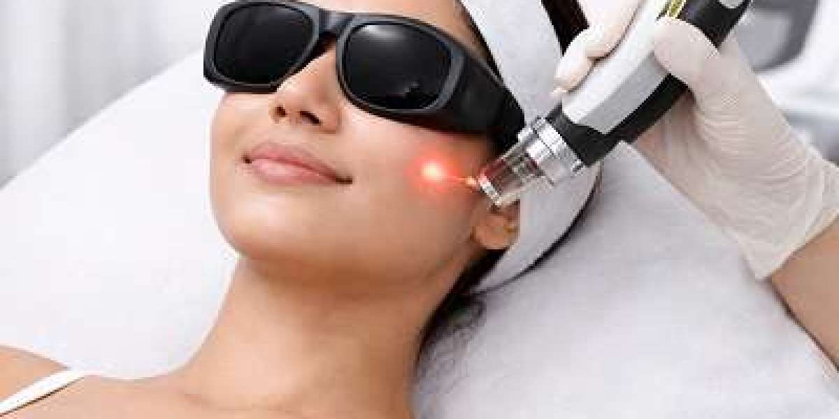 Can Pico Laser Treat Dull Skin?