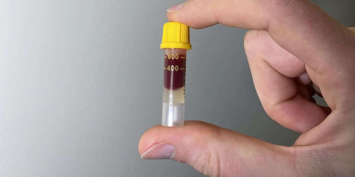 Blood Test at Home: Signs You Should Consider Testing