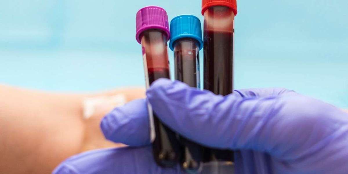 Full Blood Test: The Essential Guide to Better Health Monitoring
