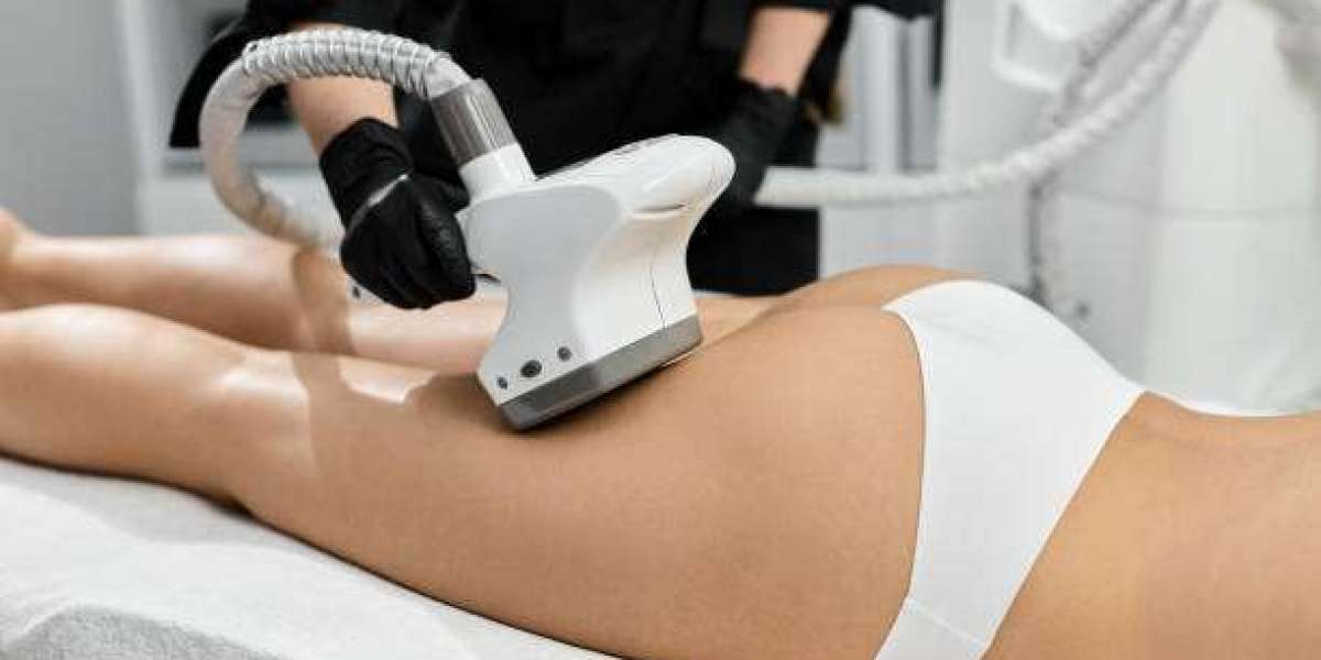 Understanding the Process of Coolsculpting Fat Freezing