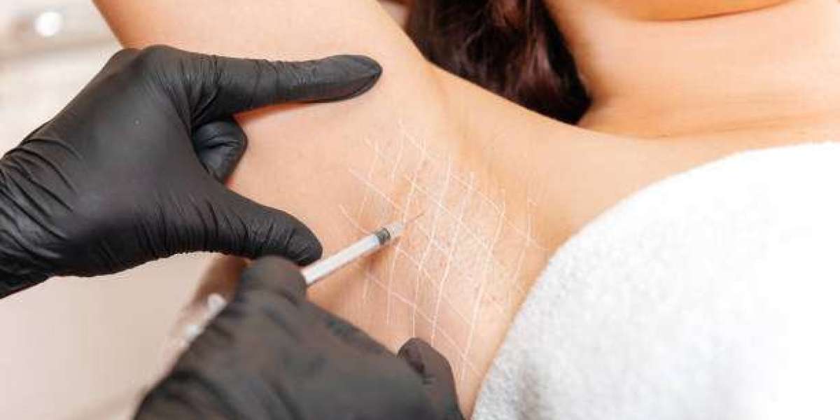 Botox Injections for Sweaty Glands in Dubai: Sweat Control