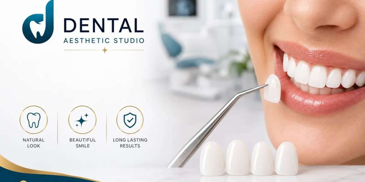 What Makes a Dental Veneer Look Natural?