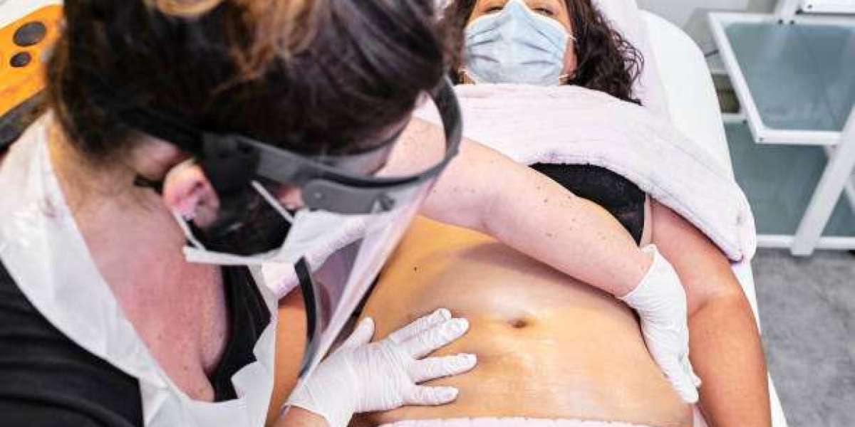 Morpheus8 Face & Body Treatment in Cape Coral, FL: What to Expect Before, During, and After Your Session