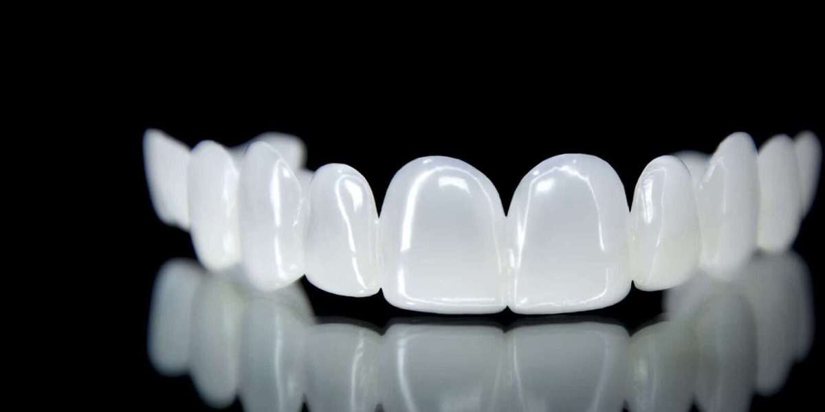 Best Dental Veneers in Dubai for Natural Results