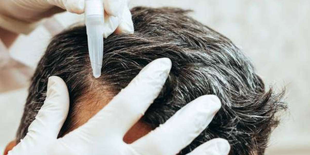 Is Exosome Hair in Dubai Right for Your Hair Loss?