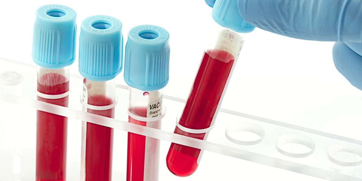 Full Blood Test for Early Health Screening