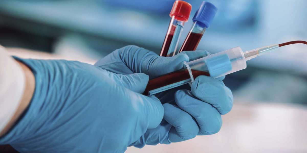 Full Blood Test for Preventive Health: Why Regular Screening Matters