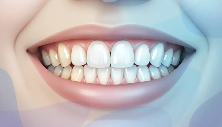 How Modern Treatments Can Transform Your Smile