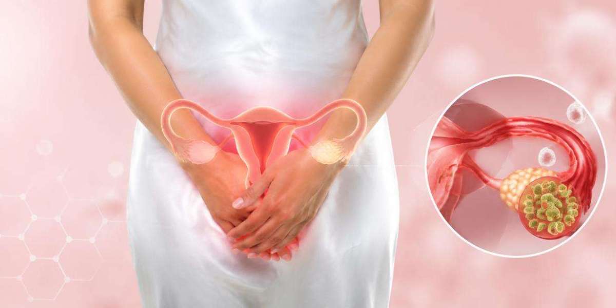 Signs and Symptoms of Pelvic Inflammatory Disease