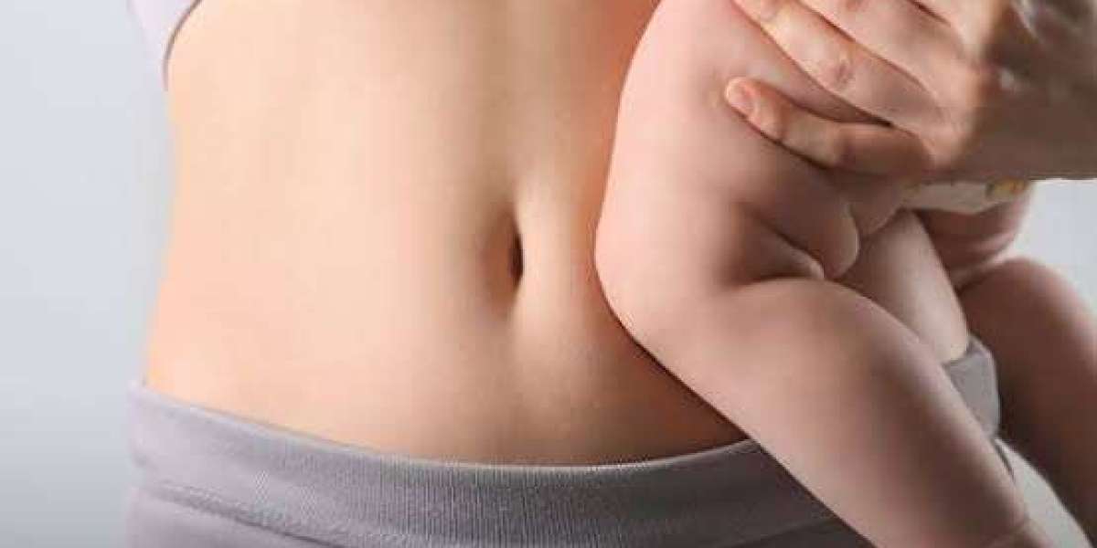 Mommy Makeover Dubai Prices Compared: What Affects the Cost?