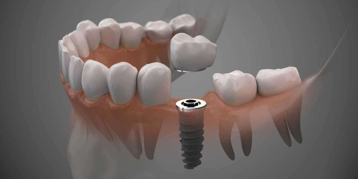 Dental Clinic Checkups for Healthy Teeth and Gums
