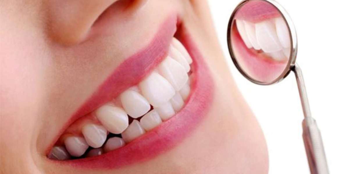 Teeth Cleaning Dubai: Cost, Benefits and Procedure