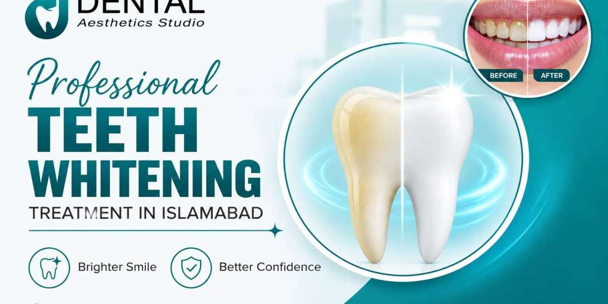Teeth Whitening for a More Confident Smile: What to Know