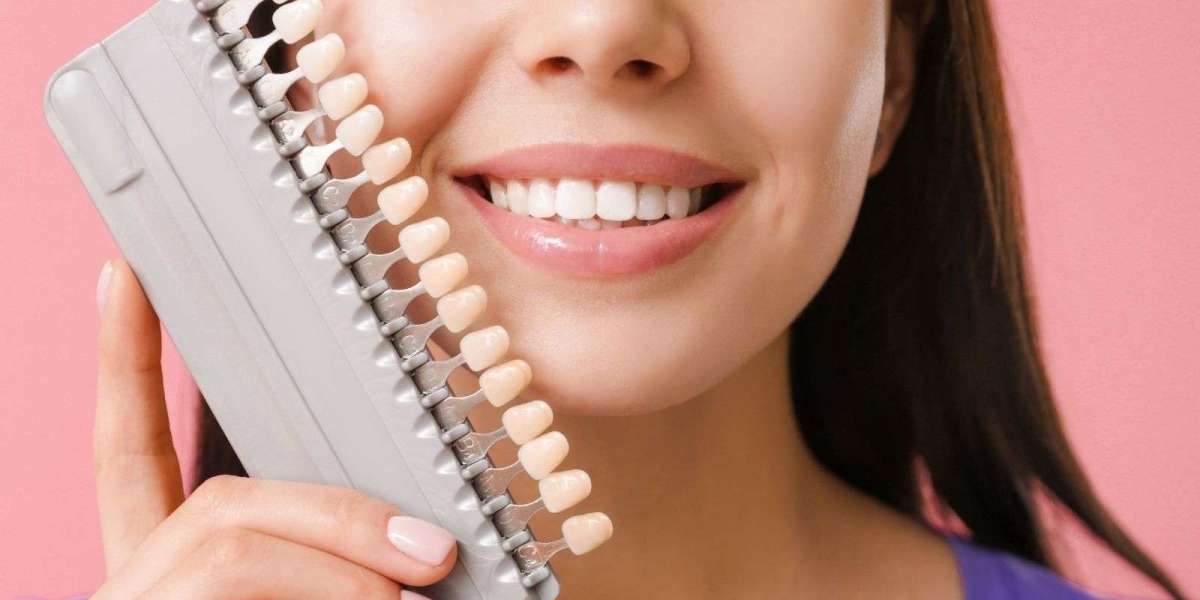 Dental Implants in Dubai: Benefits and Treatment Process