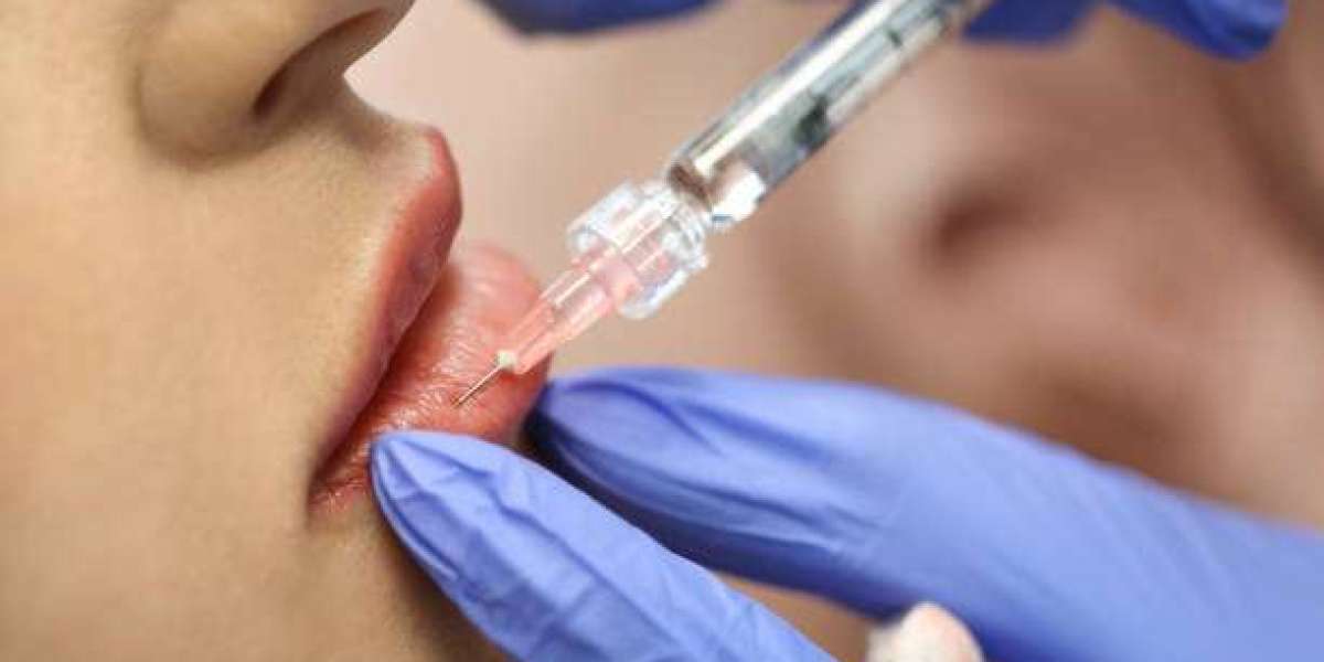 What Results Can Russian Lip Fillers in Dubai Deliver Today?