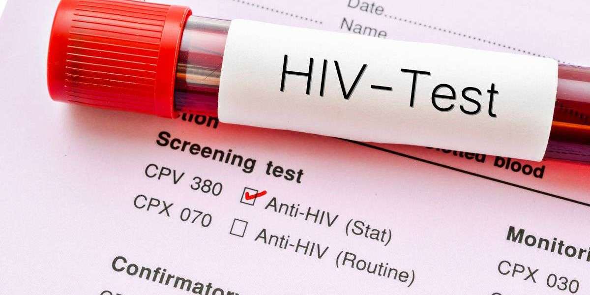HIV Blood Test: Preparing for Your HIV Screening