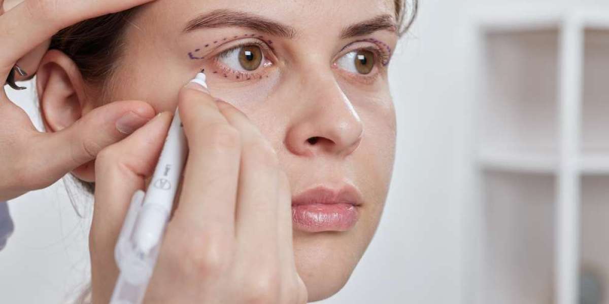 Article Picture