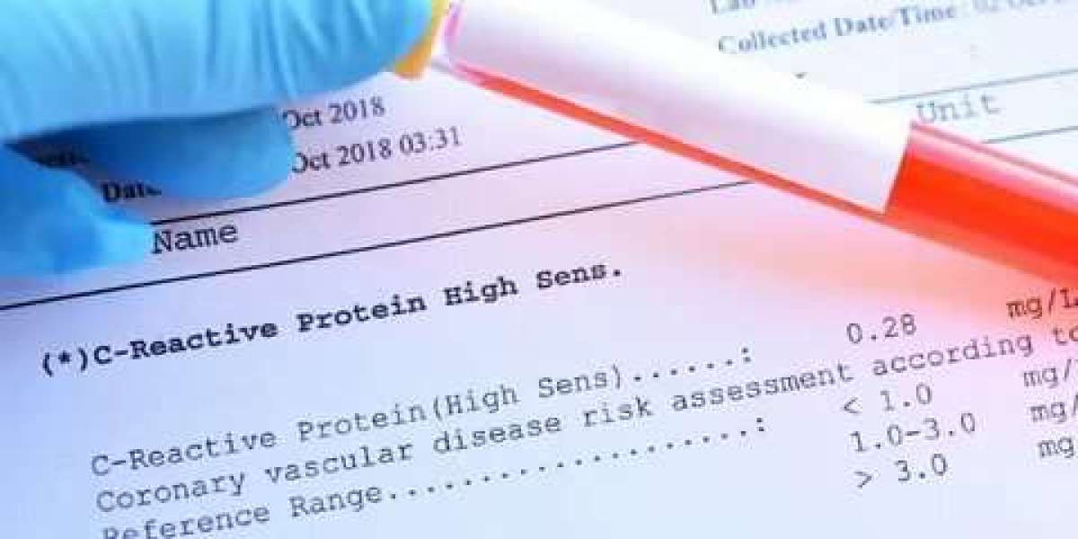 How Accurate Is a Calcium Blood Test? Understanding Test Results