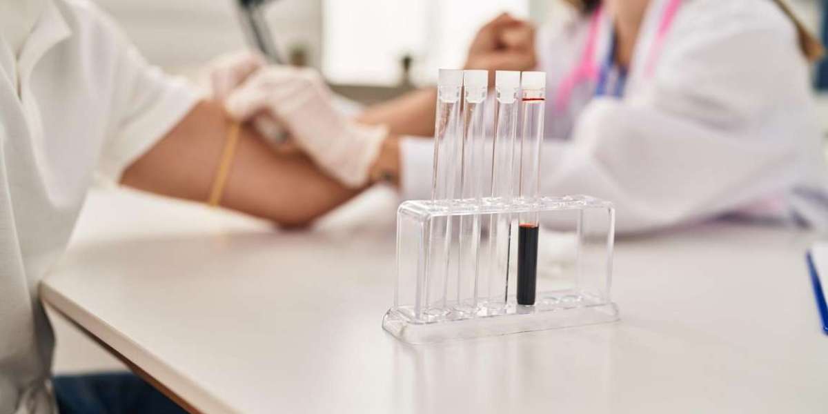 What Factors Can Affect Amylase Test Results?
