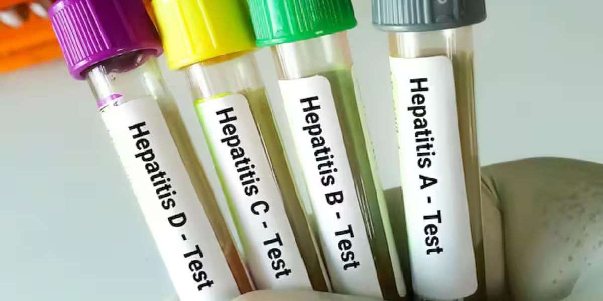 Hepatitis B Testing After Possible Exposure