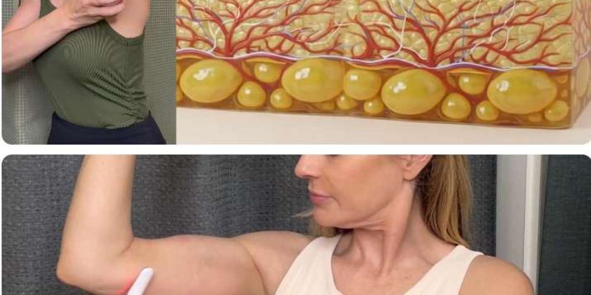 MyoGlow Skin Tightener