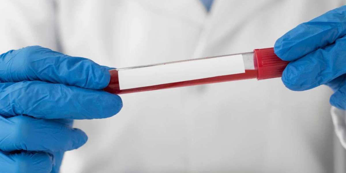 HIV Blood Test: Questions You May Have