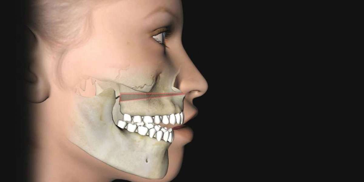 A Patient’s Guide to Choosing a Jaw Surgery Clinic in Islamabad