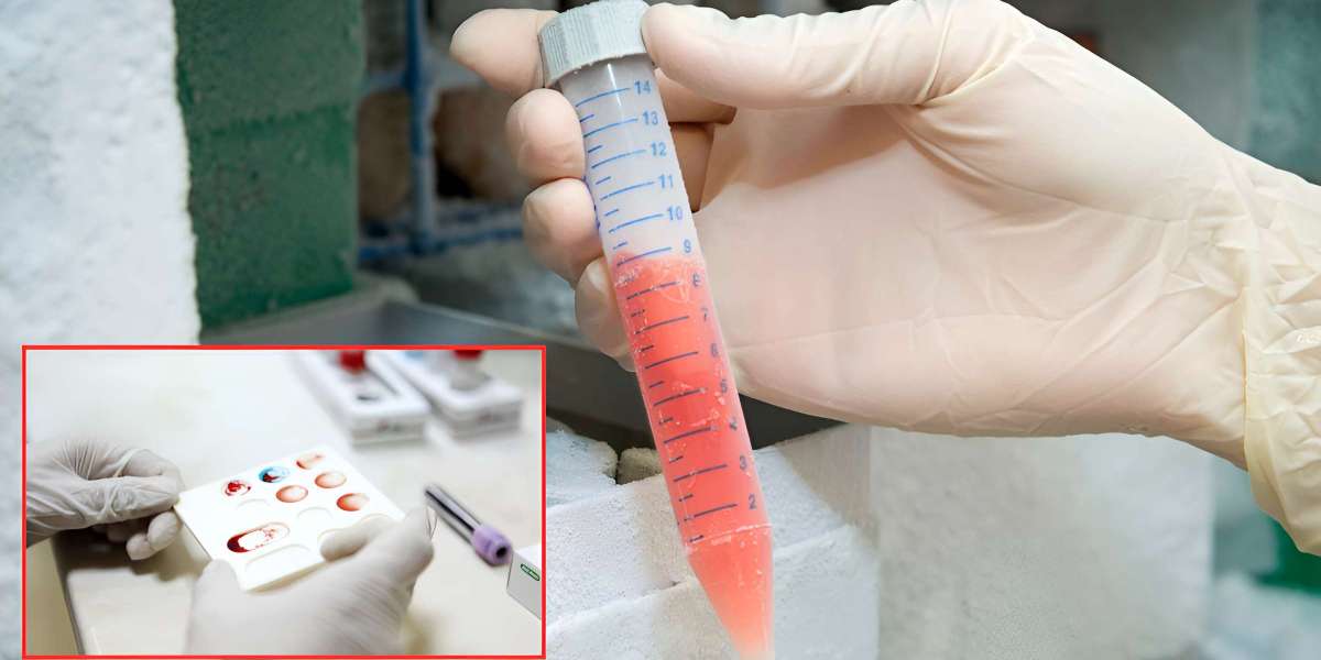 Copper Blood Test: Signs of Low Copper Levels