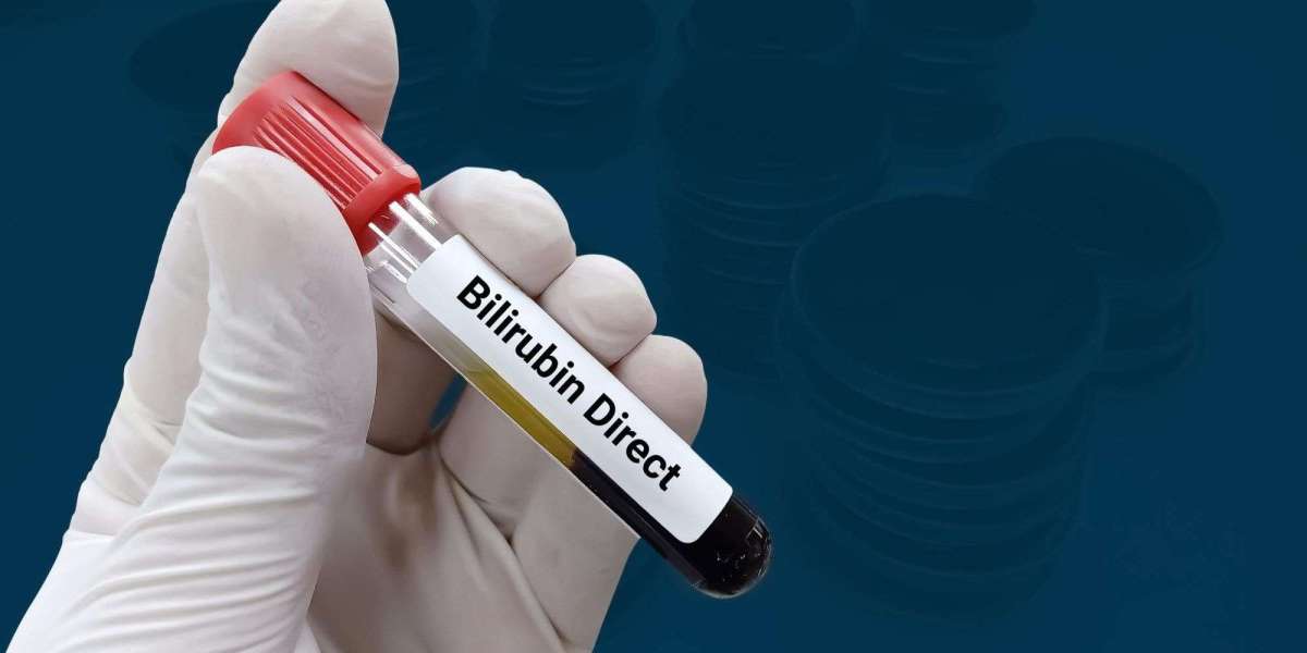 Bilirubin Total Test: What Is Considered a Normal Bilirubin Level?