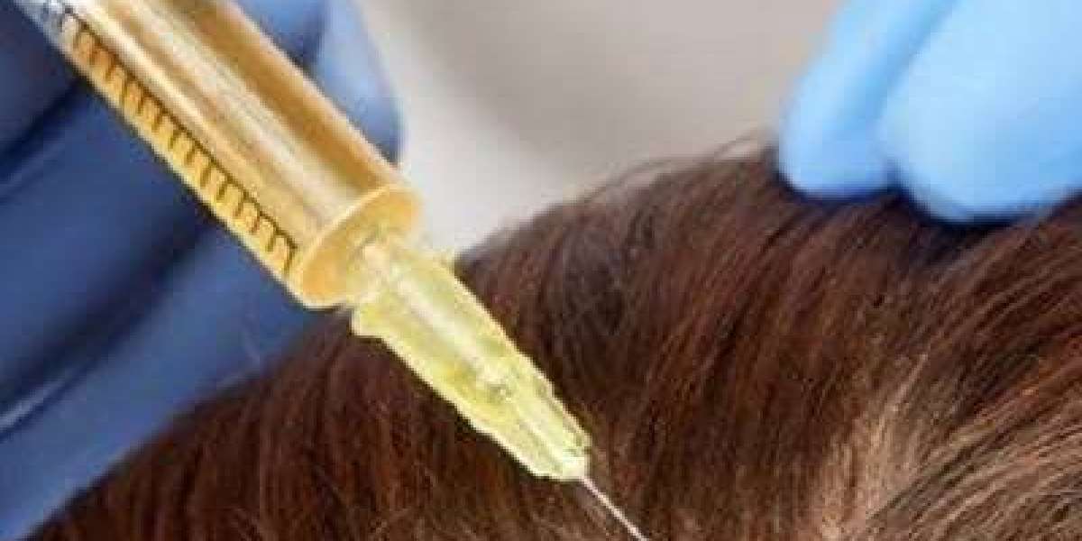 هل حقن البلازما تعالج الصلع الوراثي أم تساقط الشعر المؤقت فقط؟